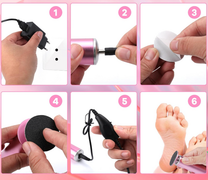 Marellian Elektrikli Ayak Nasır Giderici