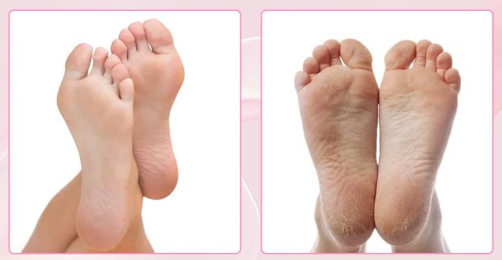 Marellian Elektrikli Ayak Nasır Giderici